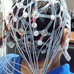 EEG Machine