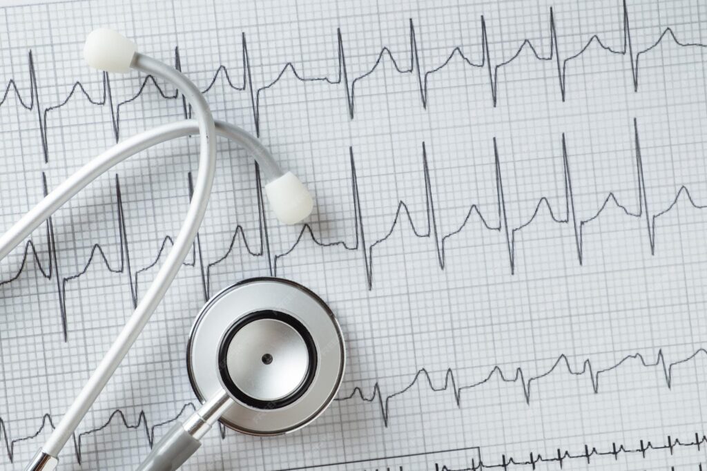 ECG Machines in Guwahati